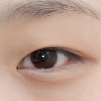 开前眼角