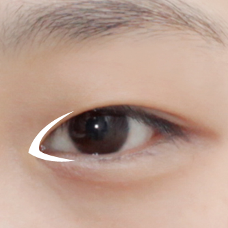 开前眼角